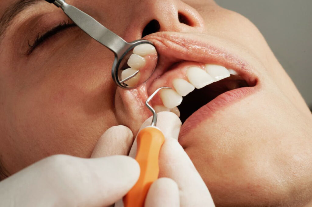 A professional dentist performing a teeth scaling procedure on a patient in a modern dental clinic in Lahore.