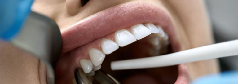 Tooth Extraction Dental Surgeons Gulberg Lahore