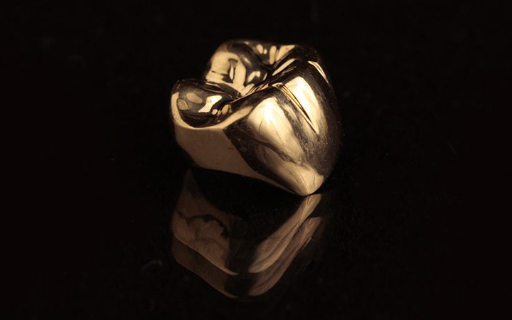 Gold Crown Dental Surgeons Lahore