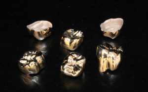 Gold Crown Dental Surgeons Lahore