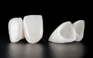 Clinical Insights into Wisdom Teeth: Comprehensive Management and Patient Care at Dental Wisdom Zirconia Crown Dental Surgeons Lahore