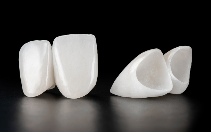 Zirconia Crown Dental Surgeons Lahore