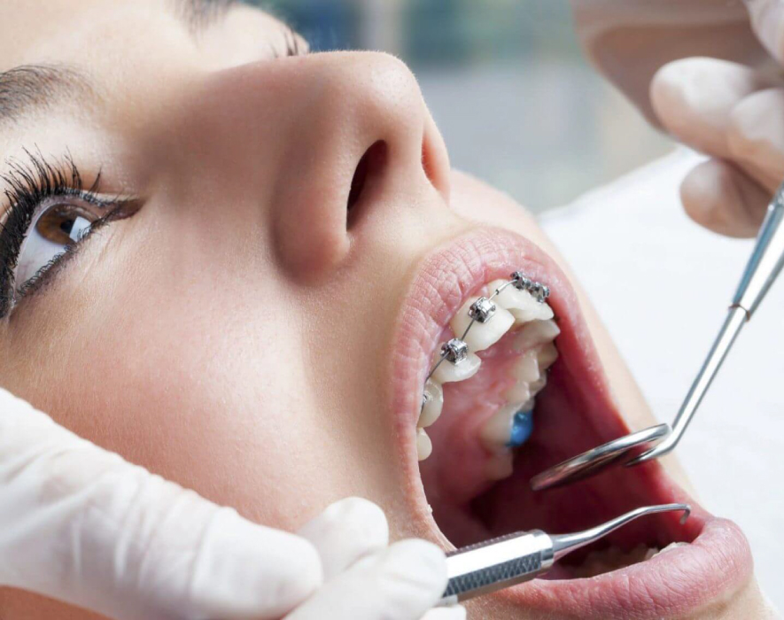 A patient undergoing an orthodontics consultation to discuss braces and alignment at a dental clinic.