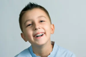 Best Age for Braces