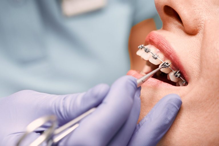 Cosmetology Dentist & Dental Cleaning Polish: orthodontic Treatment