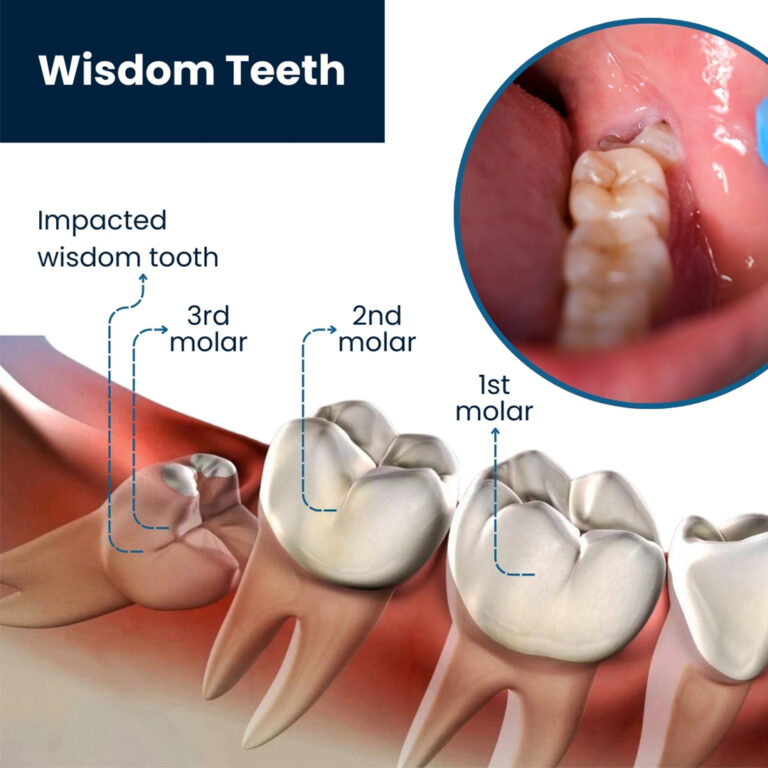 DENTAL SURGEONS TREATMENT