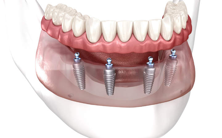 Comprehensive Oral Care: From Cosmetic Enhancements